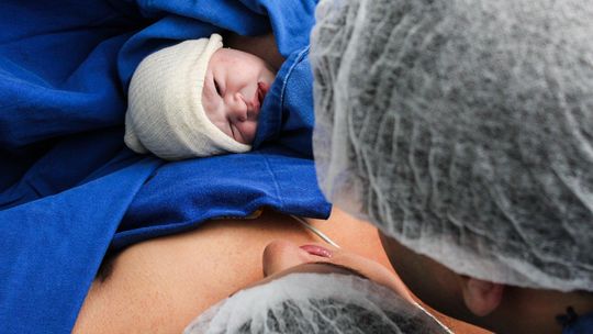 Poród bez bólu. Znieczulenie zewnątrzoponowe przez całą dobę